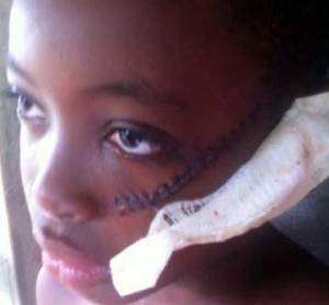 11 year old primarty student cut in face by Damaine Mckintosh with Machete cutlass Jamaica