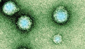 Chikungunya at the microscopic Level - Image Source: inquisitr.com