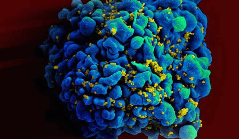 rapid hiv spreading in Cuba