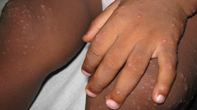Image via healthline.com